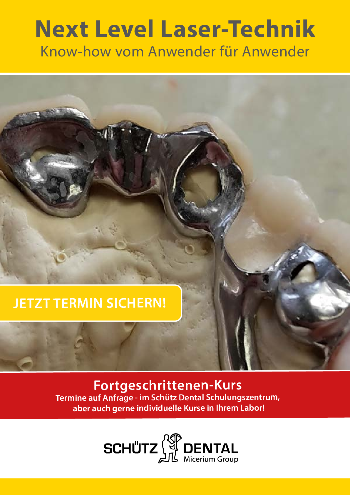 Next Level Laser-Technik