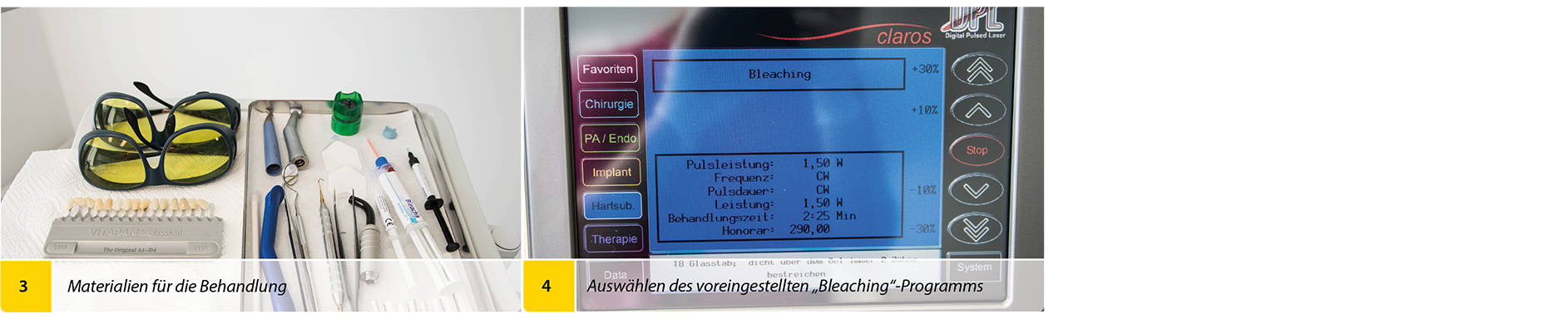 2020-04_Bleaching_Anwenderbericht_Heck_Bilder2