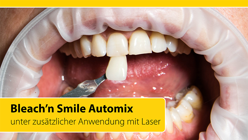 2020-04_Bleaching_Anwenderbericht_Heck_Titelbild