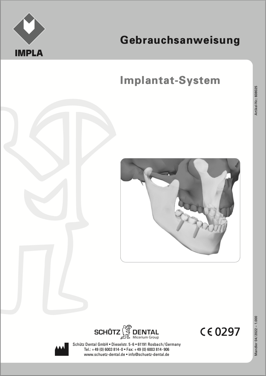 IMPLA Implantat-System (Deutsch)