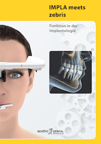 Funktion in der Implantologie (Deutsch)