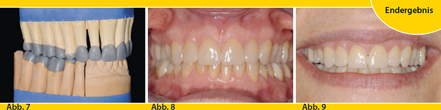 oancea3