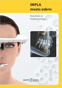 Function in Implantology (English)