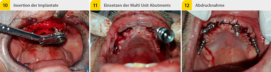 05_Schritt_10_11_12mLngMXoYzuPNt