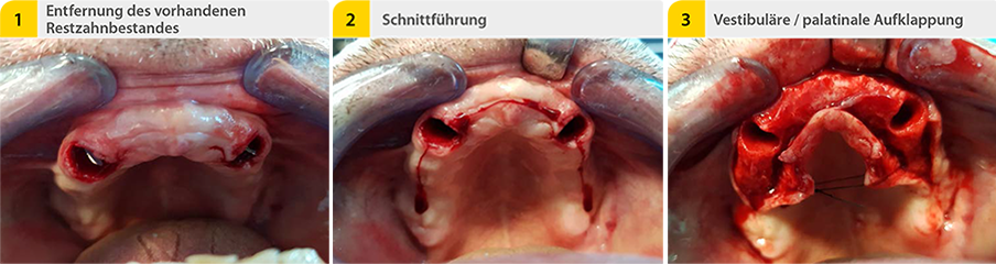 02_Schritt_1_2_3hWbbIK0bv4UmZ