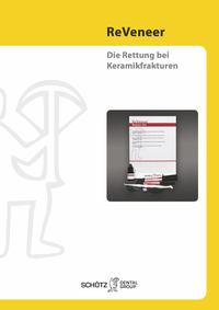 ReVeneer (Deutsch)