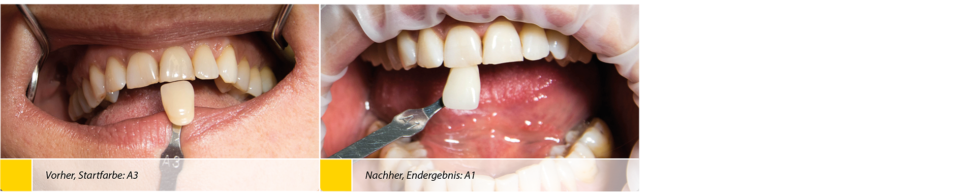 2020-04_Bleaching_Anwenderbericht_Heck_Bilder7