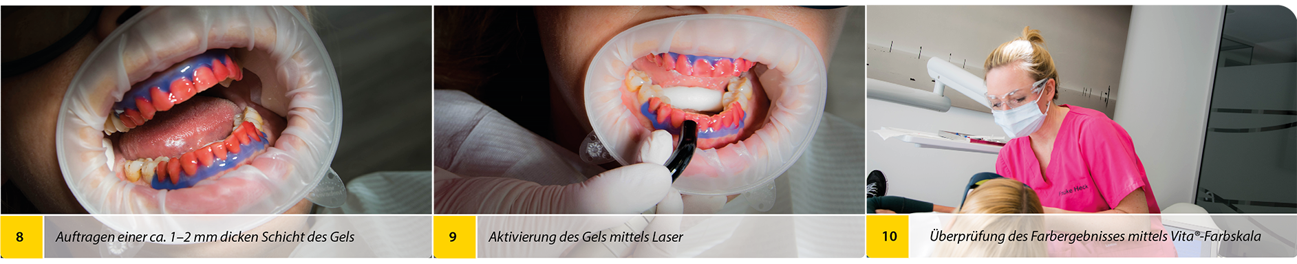 2020-04_Bleaching_Anwenderbericht_Heck_Bilder5