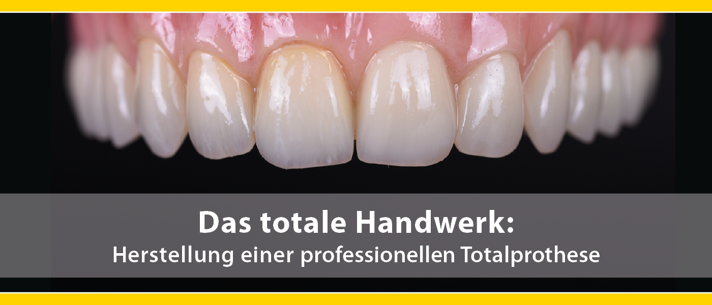Das totale Handwerk: Herstellung einer professionellen Totalprothese | Special-Events Das totale Handwerk: Herstellung einer professionellen Totalprothese | Special-Events