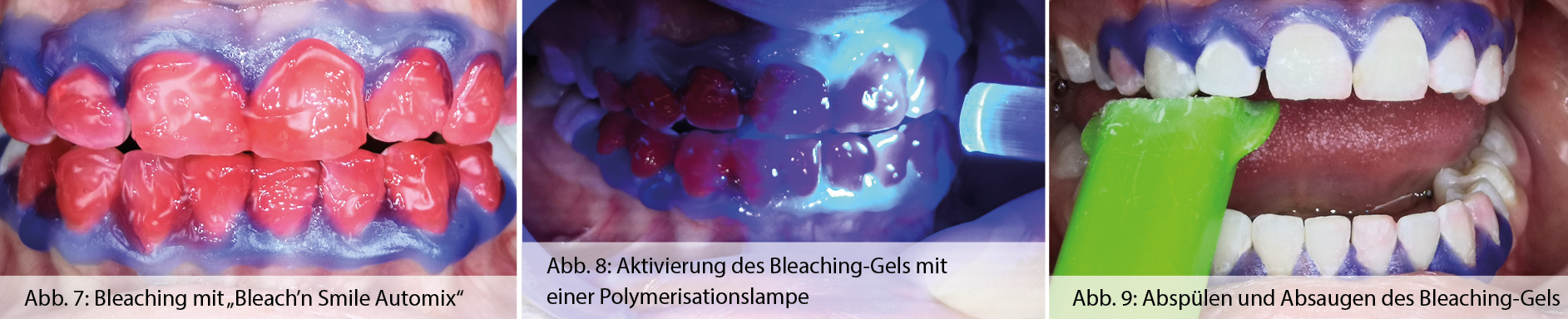 04_Newsseite_Anwenderbericht_Bleaching_banner